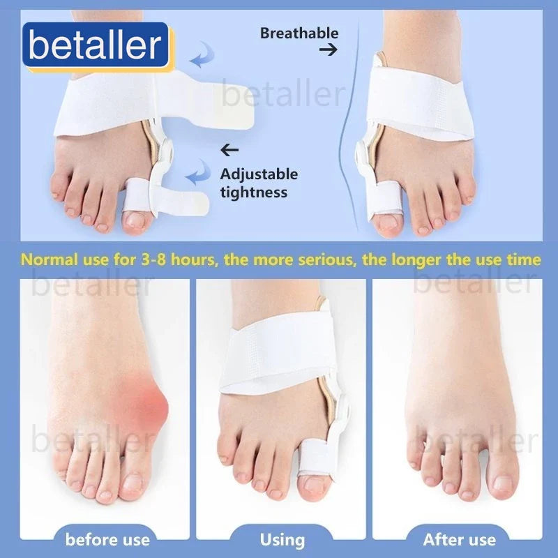 AlignToe™ Orthotic Corrector