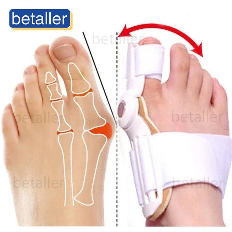 AlignToe™ Orthotic Corrector