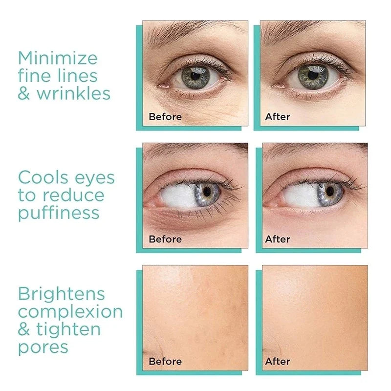 SkinRefresh™ Instant Eye De-Puffing Globes